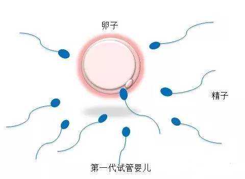 呼和浩特正规供卵试管婴儿，胎动在左边是生男孩还是女孩