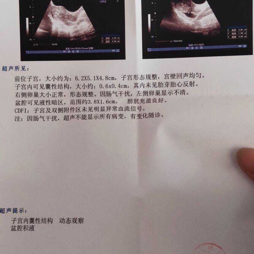 江苏供卵盲捐，江苏做试管婴儿贵吗？大概要多少钱？